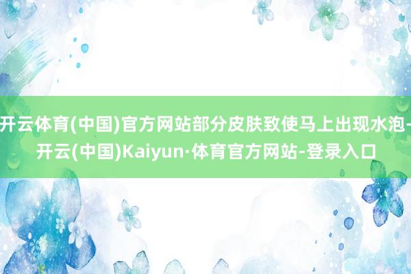 开云体育(中国)官方网站部分皮肤致使马上出现水泡-开云(中国)Kaiyun·体育官方网站-登录入口
